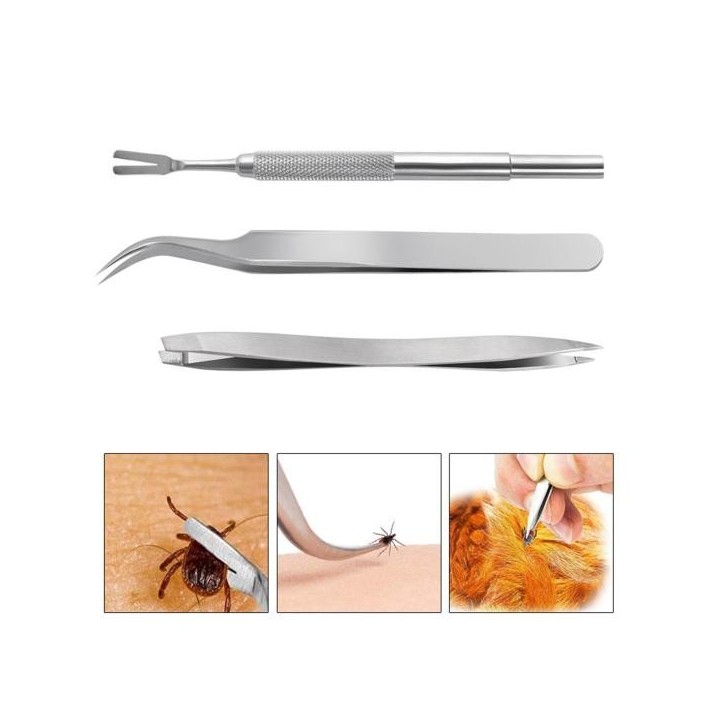 Entfernungswerkzeug aus Edelstahl für Haustiere, einfach, langlebig, effektiver Zeckenentferner für Hunde, Katzen, Menschen